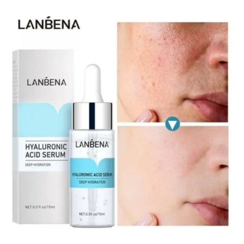 Serum Lanbena Ácido Hialurónico