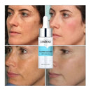 Serum Lanbena Ácido Hialurónico