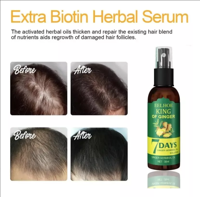 Spray para el crecimiento del cabello de 7 días: fortalece y combate la caída del cabello