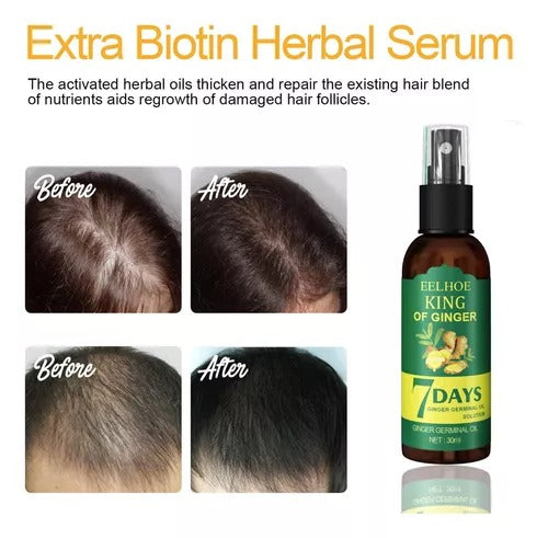 Spray para el crecimiento del cabello de 7 días: fortalece y combate la caída del cabello